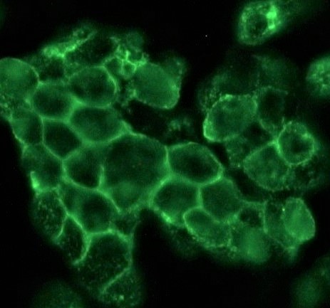 Figure 1. Indirect immunofluorescence staining of human small cell lung cancer cells (NCI-H82) in tissue culture with 0566P (diluted 1:500), showing the specific staining pattern of NCAM/CD56 adhesion sites in between the individual cells.